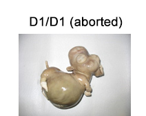 D1/D1 Aborted Dwarf Mini Horse